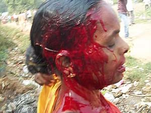 A victim of the violence at Jindal Protest. Source: 'Blood stains video'